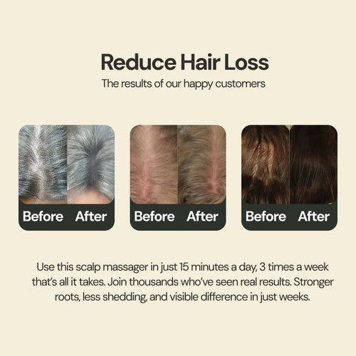 Scalp Pro