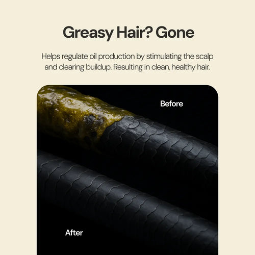Scalp Pro