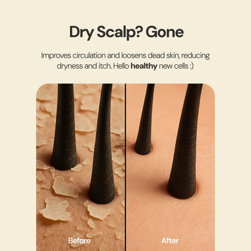 Scalp Pro